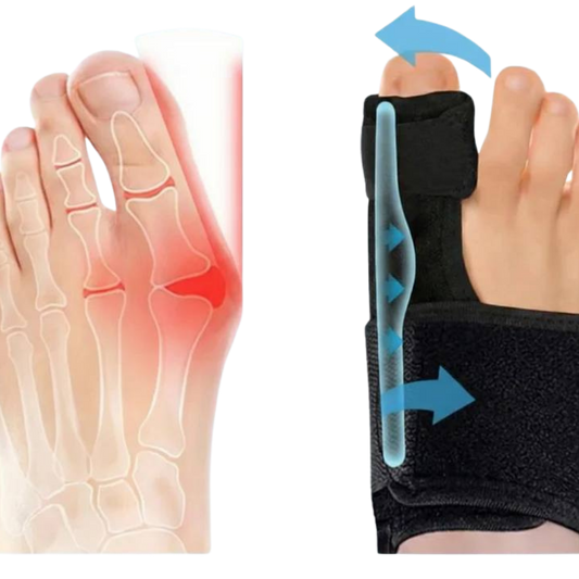 Hallux valgus douloureux soulagement en 20 min/jour, sans chirurgie.