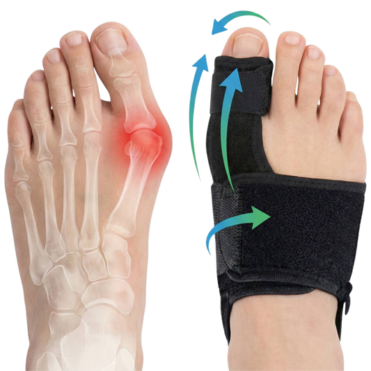 Hallux valgus douloureux soulagement en 20 min/jour, sans chirurgie.