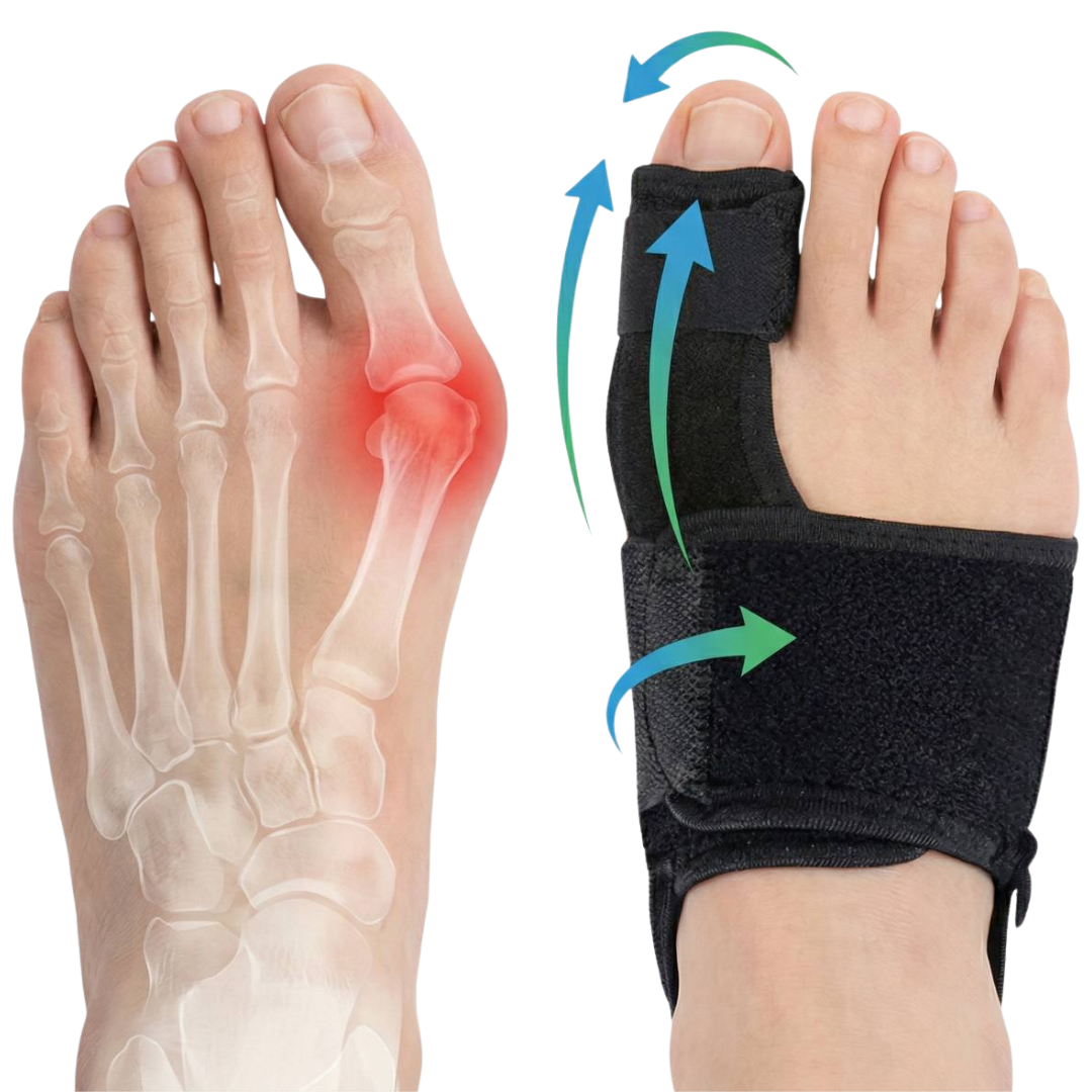 Hallux valgus douloureux soulagement en 20 min/jour, sans chirurgie.