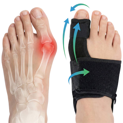 Hallux valgus douloureux soulagement en 20 min/jour, sans chirurgie.
